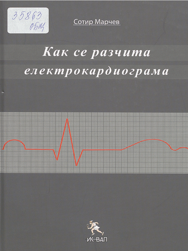 Как се разчита електрокардиограма