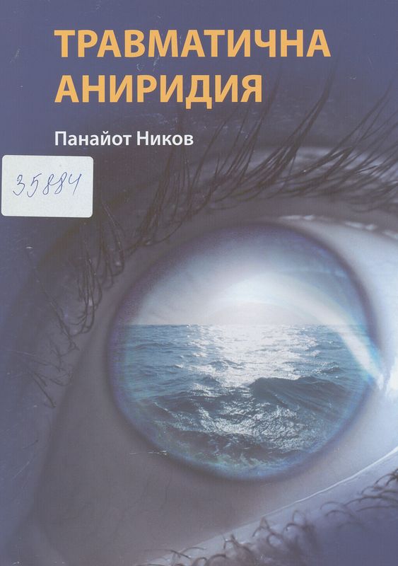 Травматична аниридия