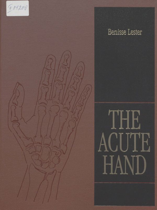 The acute hand