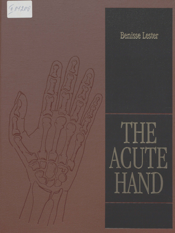The acute hand