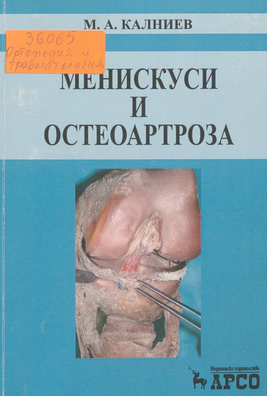 Менискуси и остеоартроза