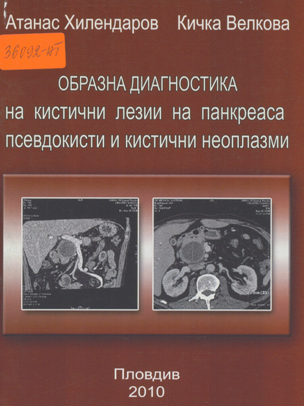 Образна диагностика на кистични лезии на панкреаса