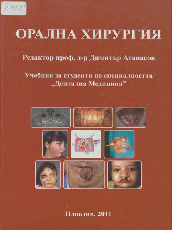 Орална хирургия