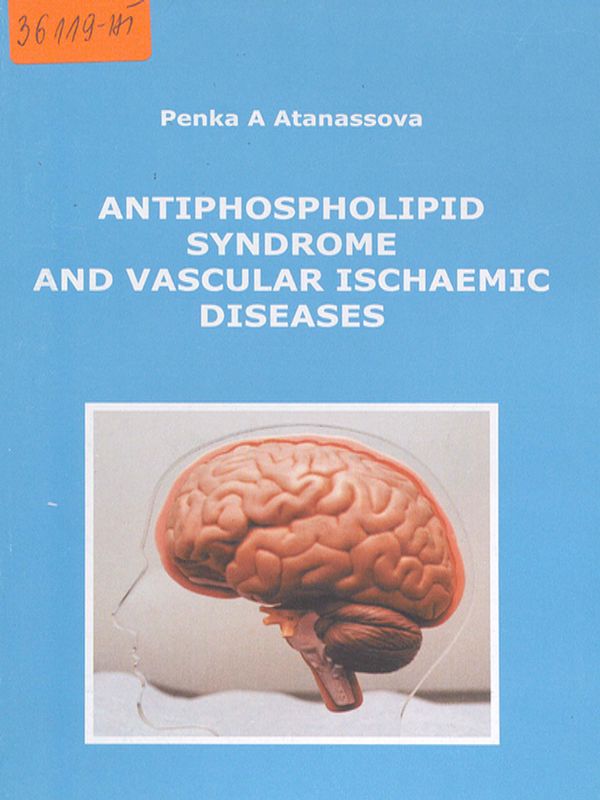 Antiphospholipid syndrome and vascular ischaemic diseases
