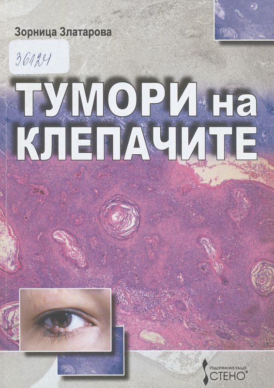 Тумори на клепачите