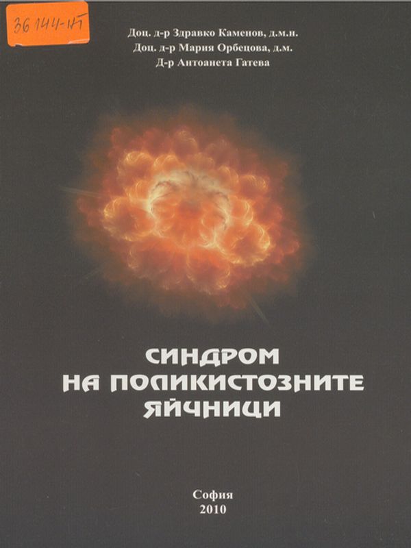 Синдром на поликистозните яйчници