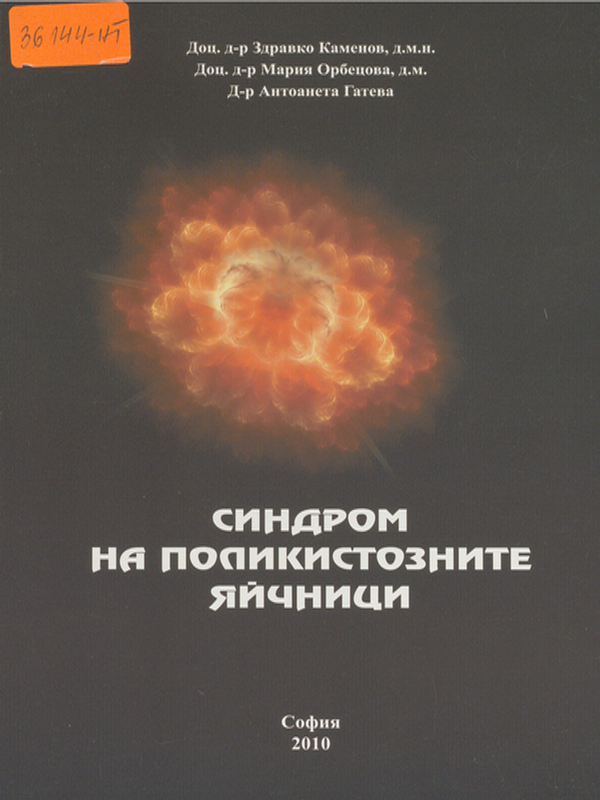 Синдром на поликистозните яйчници