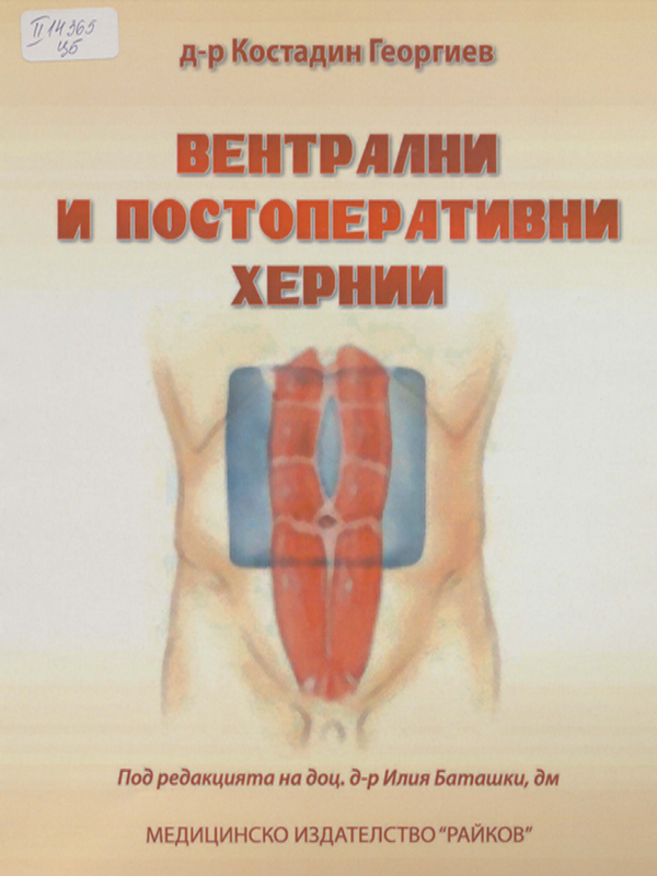 Вентрални и постоперативни хернии