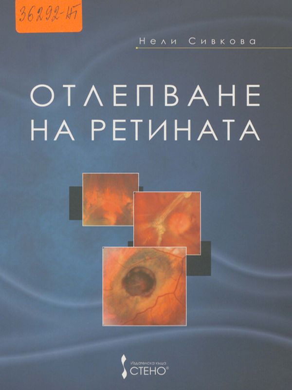 Отлепване на ретината