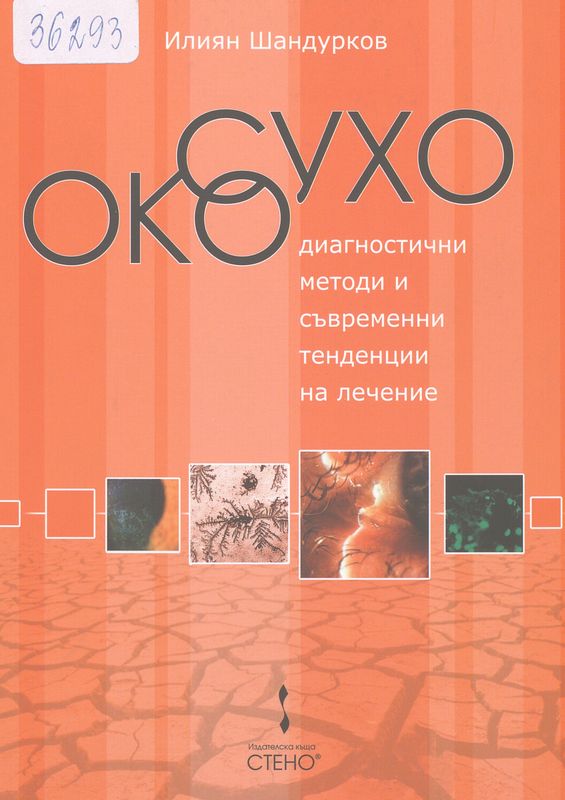 Сухо око - диагностични методи и съвременни тенденции на лечение