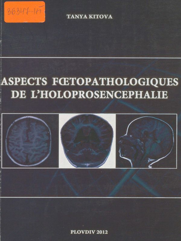 Aspects foetopathologiques de l`holoprosencephalie
