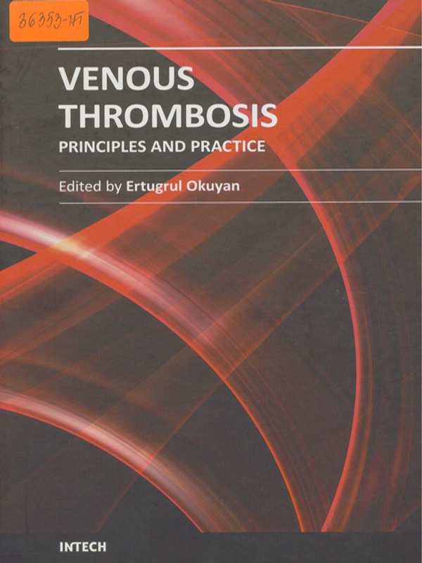 Venous thrombosis - principles and practuce