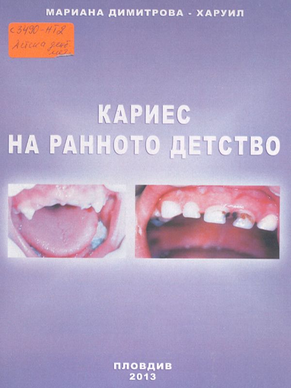 Кариес на ранното детство