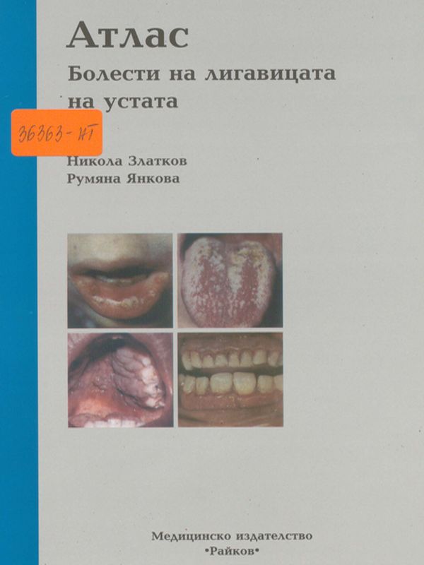 Атлас - Болести на лигавицата на устата