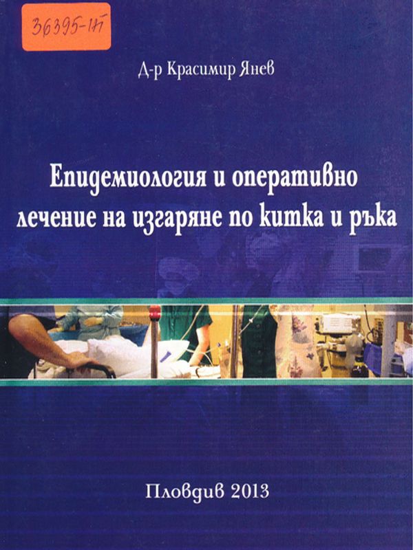 Епидемиология и оперативно лечение на изгаряне по китка и ръка
