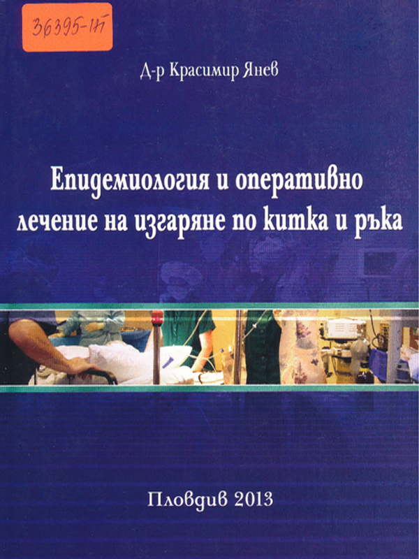 Епидемиология и оперативно лечение на изгаряне по китка и ръка