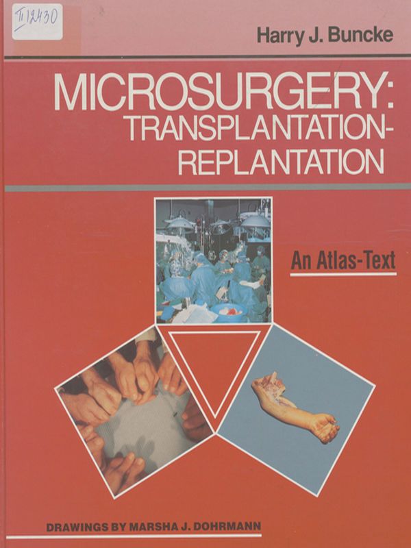 Microsurgery: transplantation, replantation