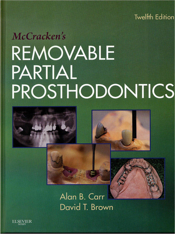 McCracken`s removable partial prosthodontics