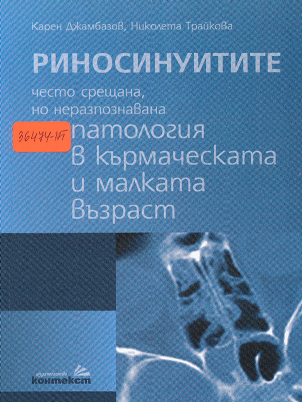 Риносинуитите - често срещана, но неразпознавана патология в кърмаческата и малката възраст