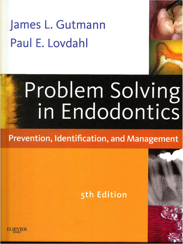 Problem solving in endodontics