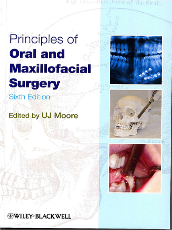 Principles of oral and maxillofacial surgery