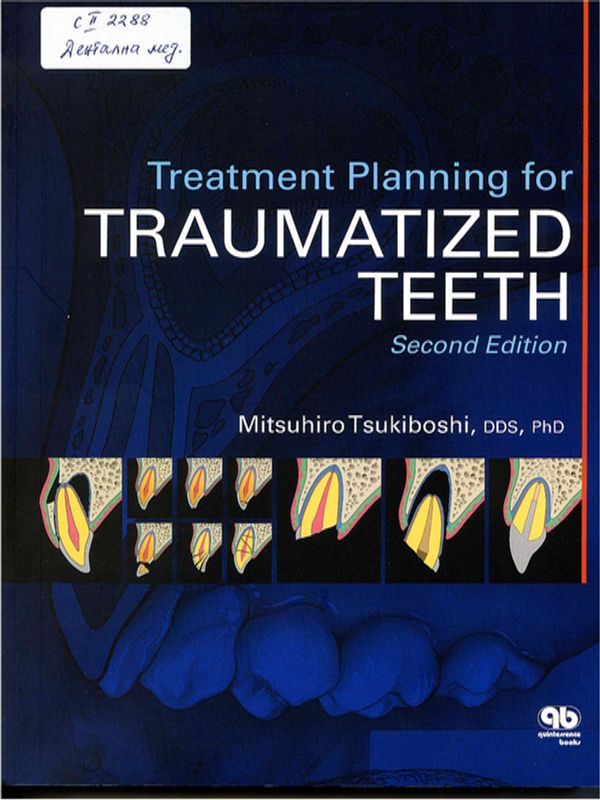 Treatment planning for traumatized teeth