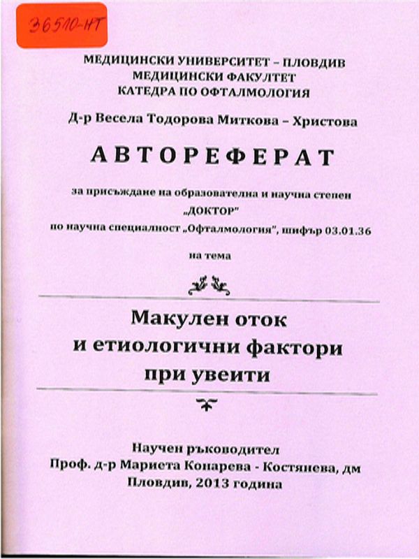 Макулен оток и етиологични фактори при увеити