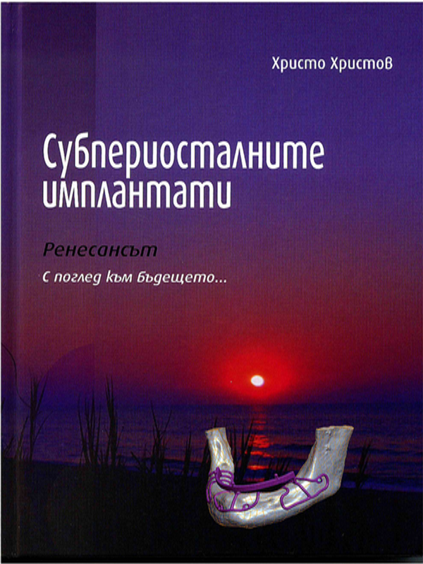 Субпериосталните импланти