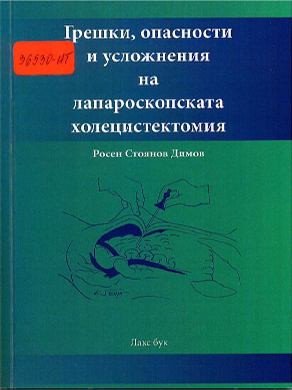 Грешки, опасности и усложнения на лапароскопската холецистектомия