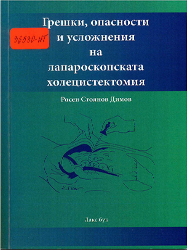 Грешки, опасности и усложнения на лапароскопската холецистектомия