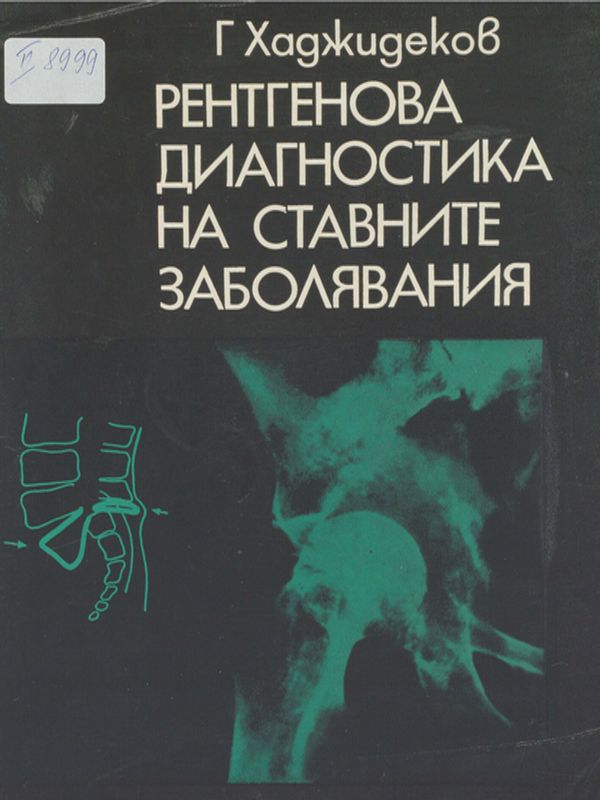 Рентгенова диагностика на ставните заболявания