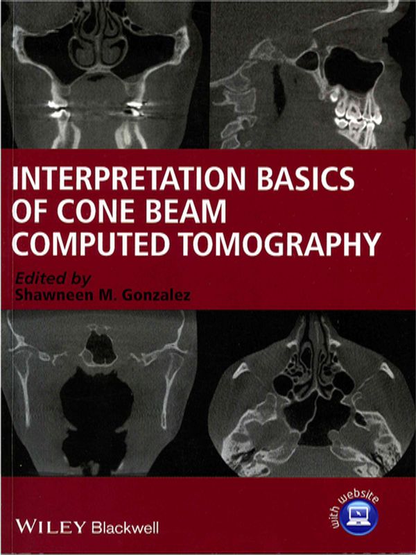 Interpretation basics of cone beam computed tomography