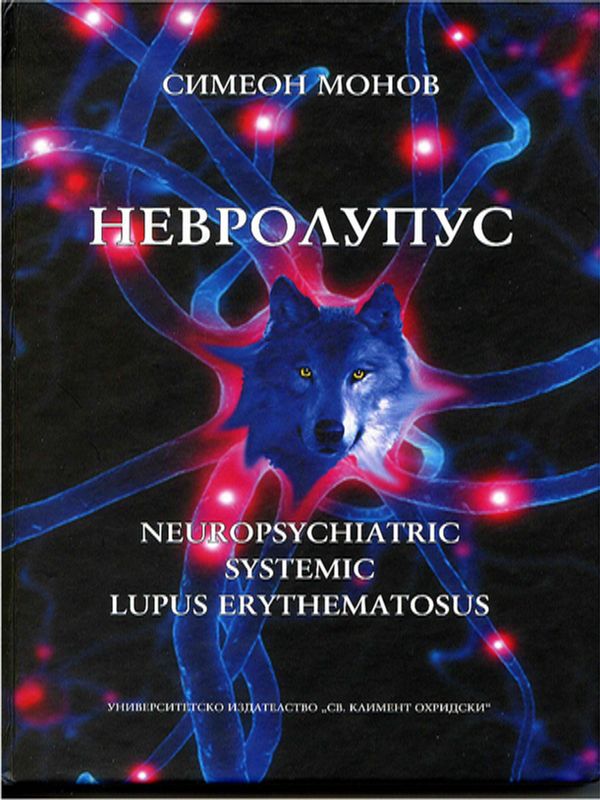 Невролупус