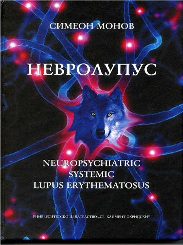 Невролупус