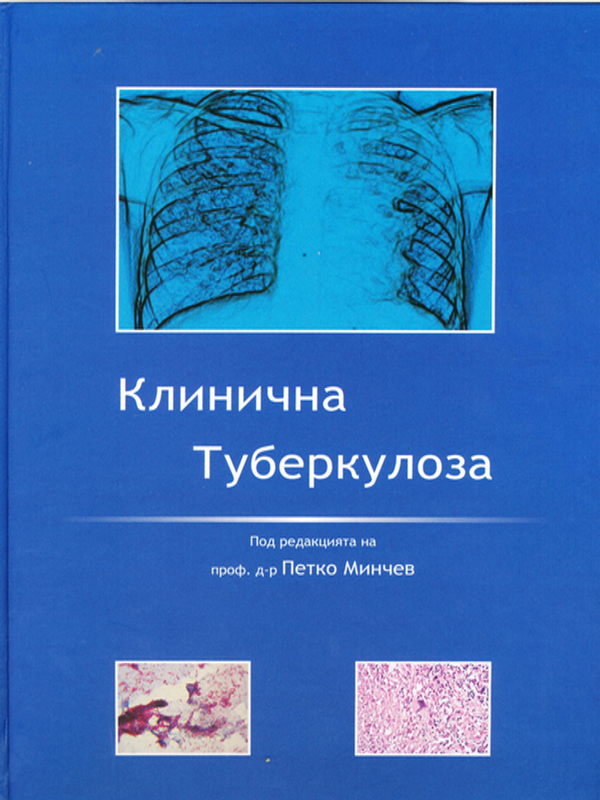 Клинична туберкулоза