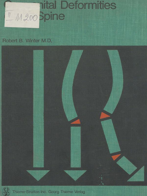 Congenital deformities of the spine