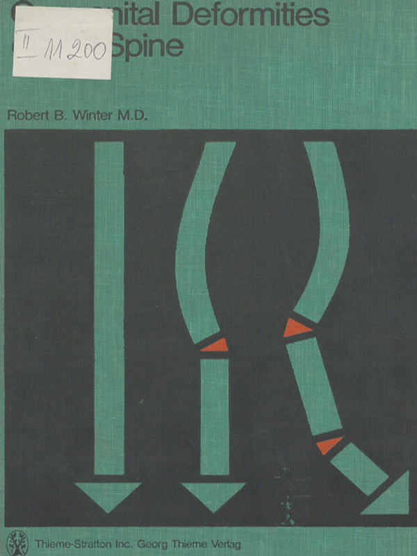 Congenital deformities of the spine