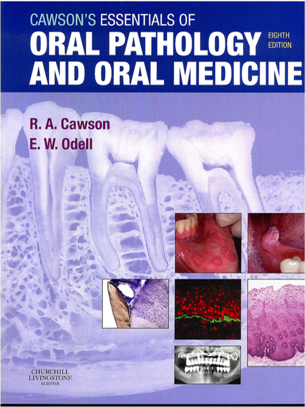 Cawson`s essentials of oral pathology and oral medicine