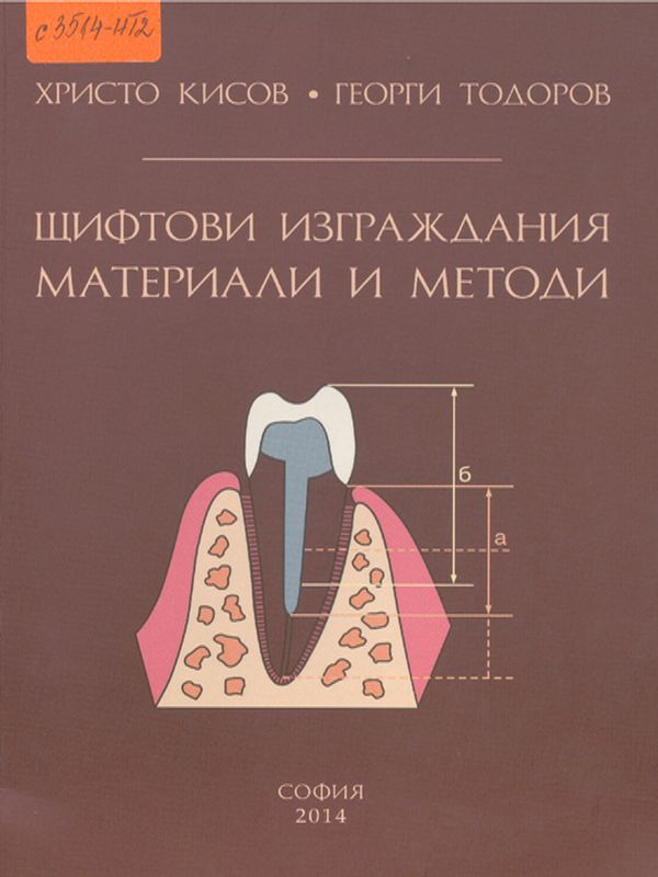 Щифтови изграждания. Материали и методи