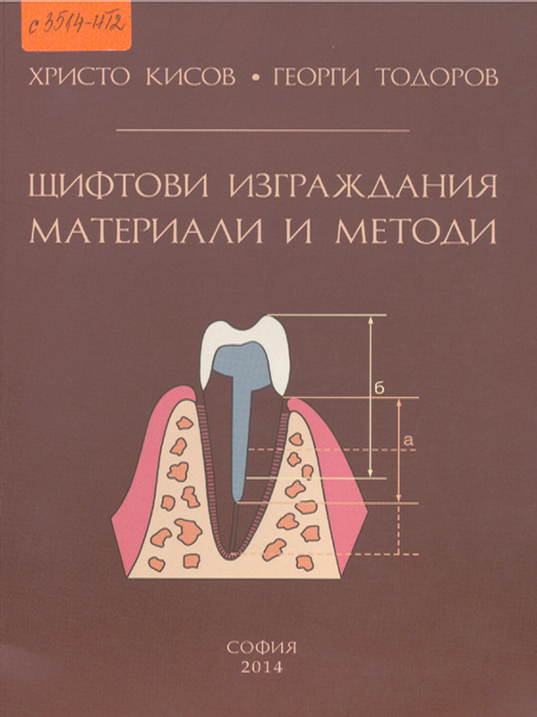 Щифтови изграждания. Материали и методи