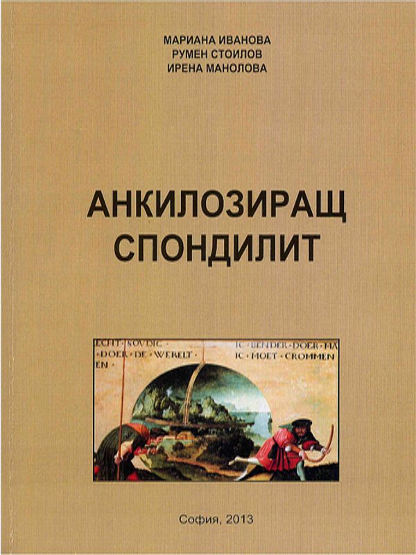 Анкилозиращ спондилит