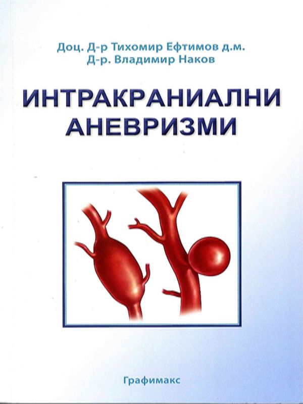 Интракраниални аневризми