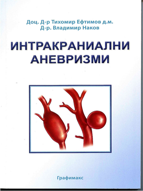 Интракраниални аневризми