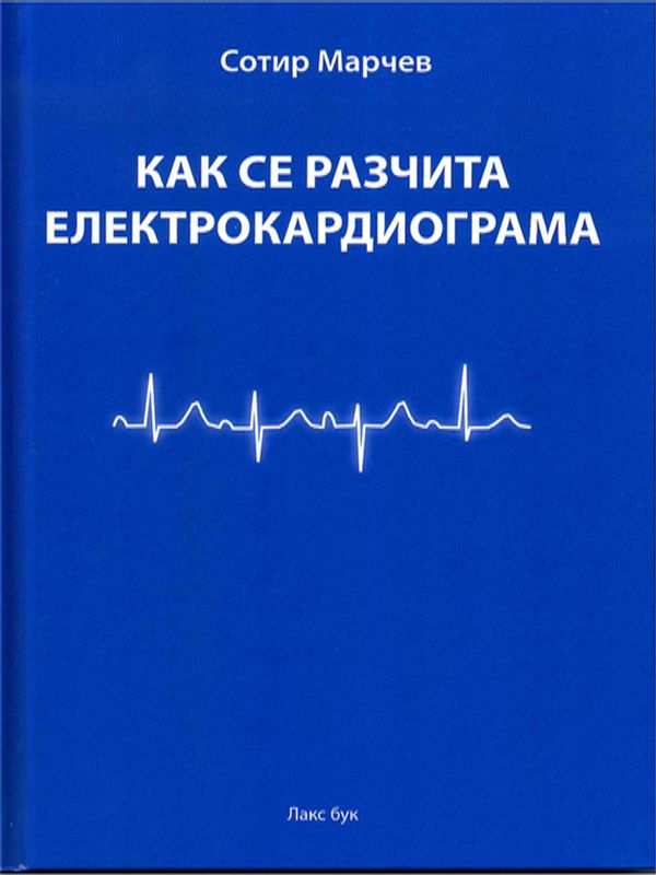Как се разчита електрокардиограма