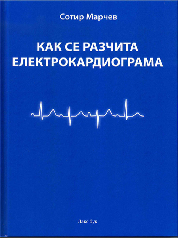 Как се разчита електрокардиограма