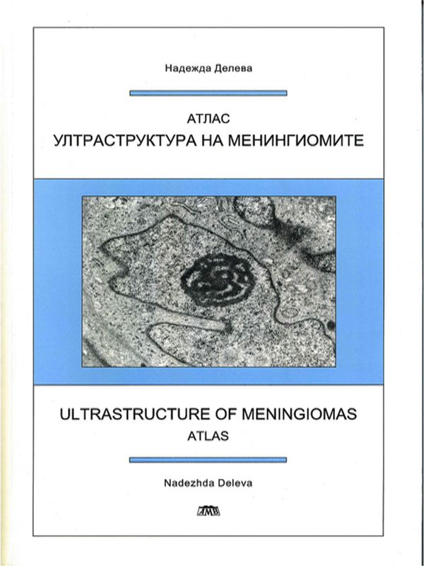 Ултраструктура на менингиомите