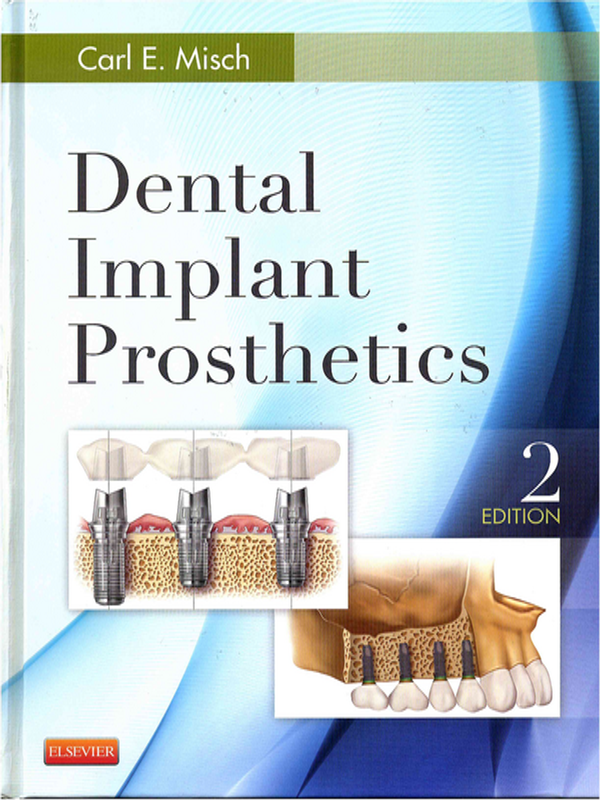 Dental implant prosthetics
