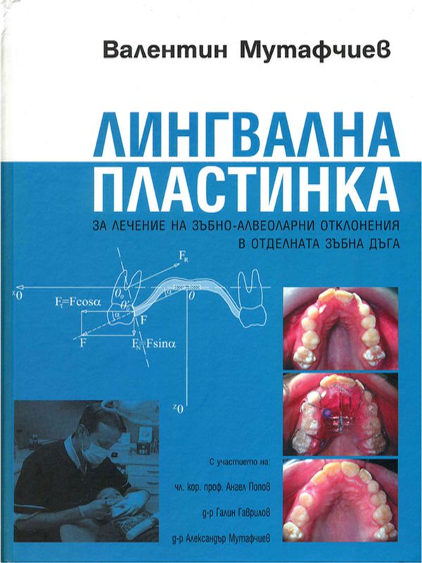 Лингвална пластинка за лечение на зъбно-алвеоларни отклонения в отделната зъбна дъга