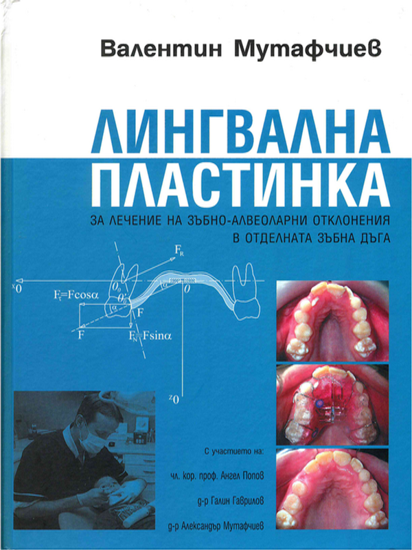 Лингвална пластинка за лечение на зъбно-алвеоларни отклонения в отделната зъбна дъга
