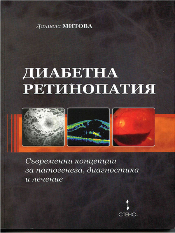 Диабетна ретинопатия